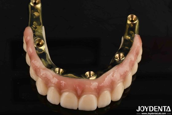 comprare Protesi dentale Ponte ibrida in zirconia a ti-bar con elevati standard di biocompatibilità fabbricazione online