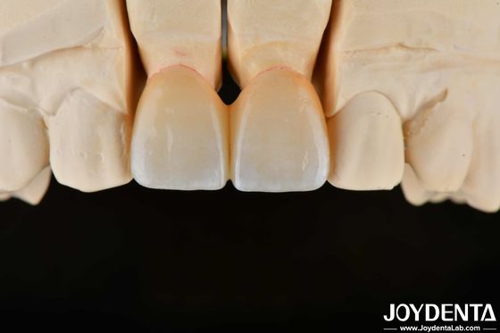 comprare 1350-1450°C Temperatura di sinterizzazione Zirconia stratificata per una biocompatibilità e una conduttività termica superiori fabbricazione online