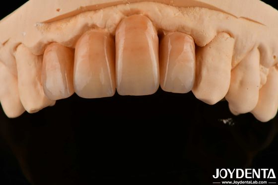 comprare Circonia stratificata lucidata bianca e resistente per una finitura superficiale perfetta fabbricazione online