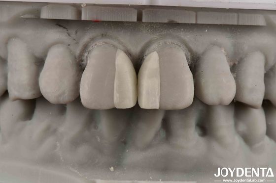 comprare Superfici curve resistenza al fuoco micro rivestimento per la decorazione degli interni fabbricazione online