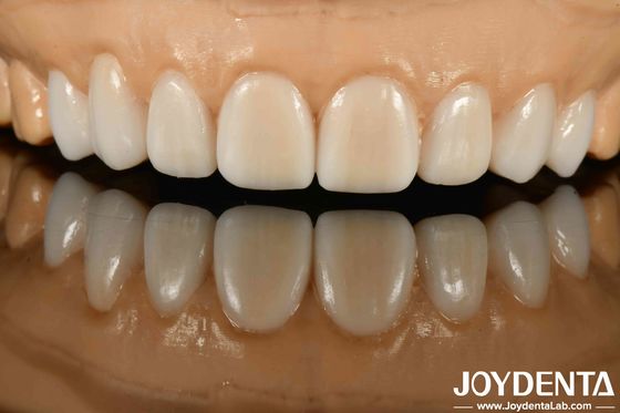 comprare Alta Stealth Materiali diversi di metalli e resine Flessibile finitura protesi per la tecnologia stealth avanzata fabbricazione online