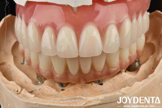 comprare Buona elasticità dentale protesi dentali acriliche Finitura con tecnologia di disposizione dei denti fabbricazione online