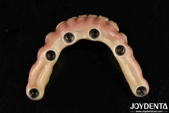 comprare Ponte ibrida in titanio Malong per cure dentali durevoli fabbricazione online