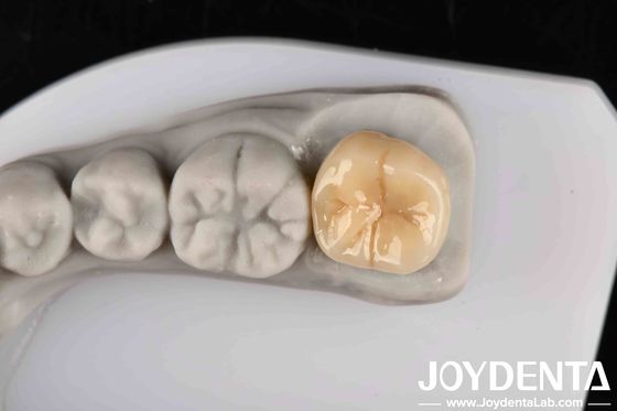 comprare Alta resistenza allo shock termico e alla corrosione Zirconia completa con eccellente stabilità chimica fabbricazione online