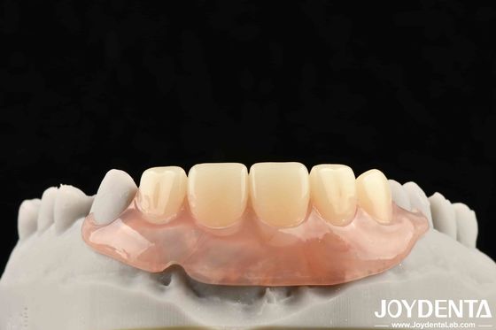 comprare Elaborare un quadro tecnologico per la creazione di finiture dentali per una struttura orale stabile nella tecnologia dentale fabbricazione online
