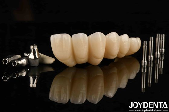 comprare Sperimenta l'estetica definitiva con l'esteticamente gradevole corona e il ponte dell'impianto dentale fabbricazione online