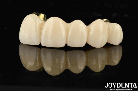 comprare Ponte ibrida in zirconia a ti-bar di eccellente resistenza per la compatibilità di denti e gengive naturali fabbricazione online