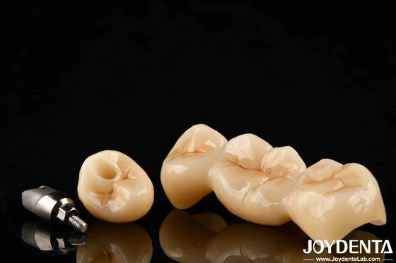 comprare Molti strati di zirconia piena, resistenza alle crepe e durabilità per restauri dentali duraturi. fabbricazione online
