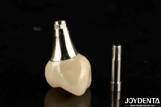 comprare Implantazione dentale biocompatibile corona e ponte esteticamente gradevole per la sicurezza orale fabbricazione online