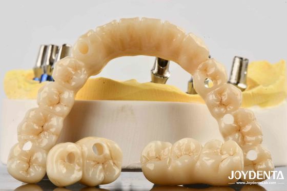 comprare Impegno per il comfort del ponte implantare in zirconio con precisione ineguagliabile fabbricazione online