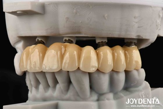 comprare Amici stretti di ossa Fondazione di bellezza Impianti di zirconia Scegliere esteticamente superiore senza rischio di allergia al metallo fabbricazione online