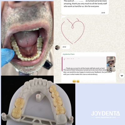 comprare Dentiere in zirconia che imitano i denti naturali fabbricazione online