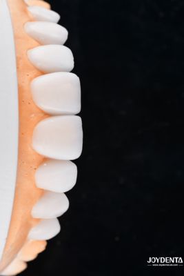 comprare Enhance Case Acceptance & Patient Communication with Our Diagnostic Wax-Up Service fabbricazione online