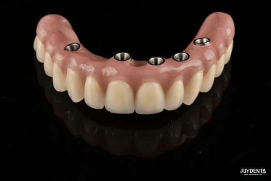 comprare Redefining Full Arch Prosthetics: Unmatched Fit and Function with Our Ti-Base Complete Dentures fabbricazione online