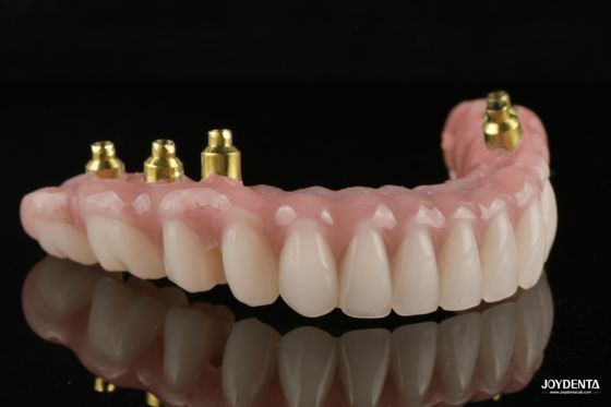 comprare The Strength of Titanium, The Art of Natural Aesthetics. fabbricazione online