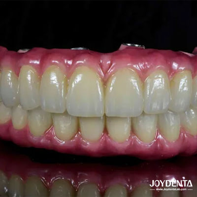 comprare Ponte ibrido di titanio leggero per la restaurazione dentale fabbricazione online