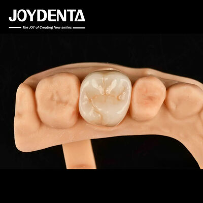 comprare Alto resistenza all'usura Dental Full Zirconia Alta resistenza Full Contour Zirconia Bridge fabbricazione online
