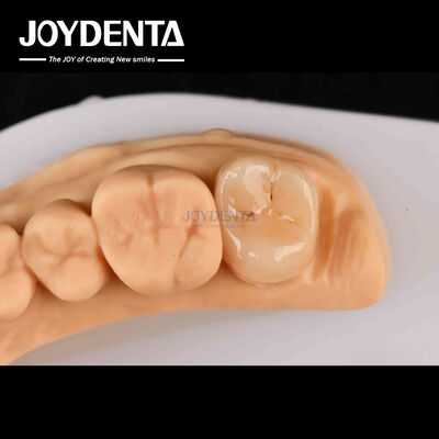 comprare Alta resistenza Emax Inlay Onlay A2 colore duraturo per il ripristino dei denti danneggiati fabbricazione online