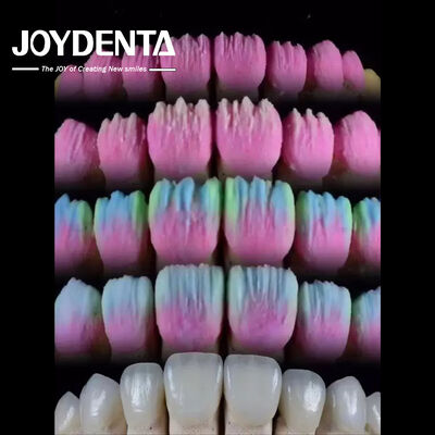 comprare The Joydenta Ceramic Veneer Process fabbricazione online