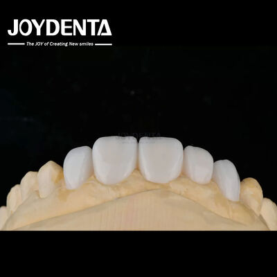comprare Materiale di porcellana di personalizzazione Emax veneers dentali per un'alta estetica di legame fabbricazione online