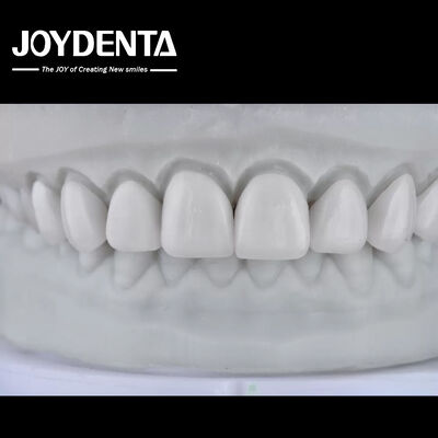 comprare Visualize the Result, Secure the Case: Our Diagnostic Wax-Up Service fabbricazione online