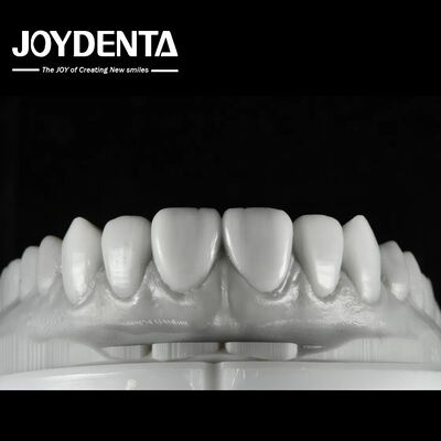 comprare Cerume dentale a colori naturali Soluzione versatile per il restauro di denti singoli o multipli fabbricazione online