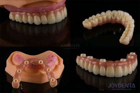 Dentistiche Protesi dentali multipli Impianti di superficie ruvida Componenti protesici