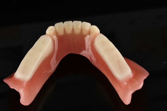 Denti artificiali ipoallergenici acrilici per la sostituzione di denti naturali