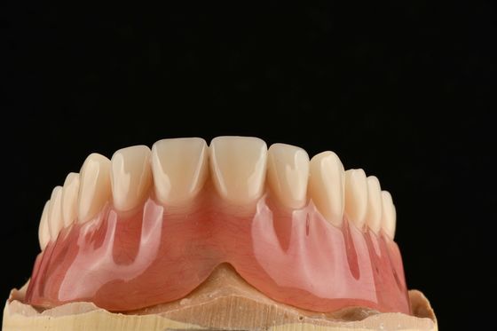 Denti comodi, chiari, regolabili, rimovibili e simili ai denti naturali