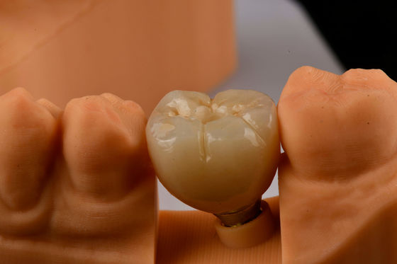 Impiantologia orale auto-taping impianti dentali mono dentale con connessione interna esessuale