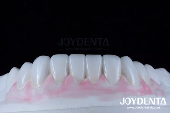 Cere digitali di diagnosi personalizzate per la replicazione dell'anatomia naturale dei denti