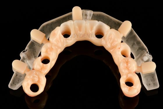 Modelli di chirurgia guidata stampati in 3D di precisione personalizzati per il posizionamento accurato degli impianti