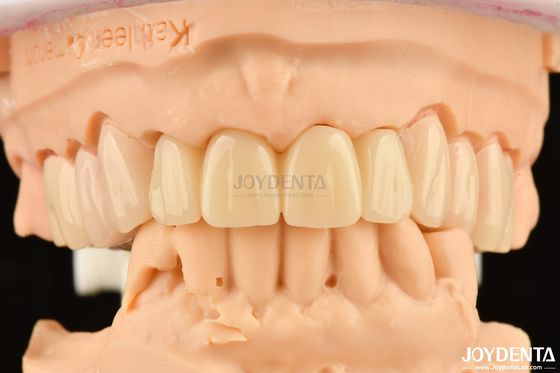 Biocompatibile PMMA M75 Restituzione resistente agli graffi per l'estetica dentale