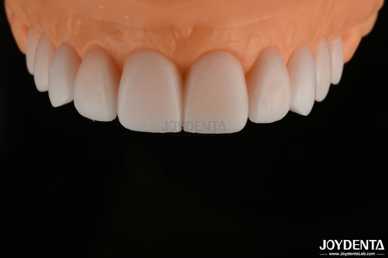 Ricreazione diagnostica liscia e replicata FDA, ricreazione dei denti ad arco completo altamente accurata