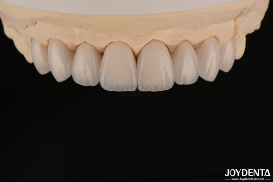 Finestre dentali lisce e leggere, biocompatibili e confortevoli per la salute orale