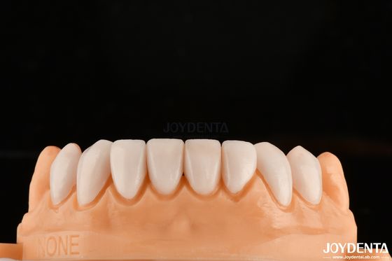 Forte legame con lo smalto dei denti per la sicurezza delle finiture dentali Personalizzazione per sfumature personalizzate per abbinare i denti naturali