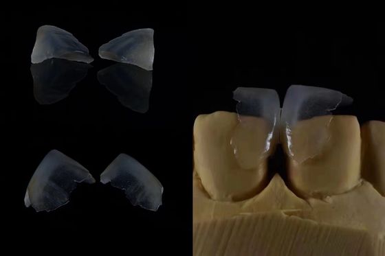 Confortevoli rivestimenti dentali forte legame con lo smalto dei denti per un adattamento sicuro leggero e liscio per un comfort ottimale del paziente