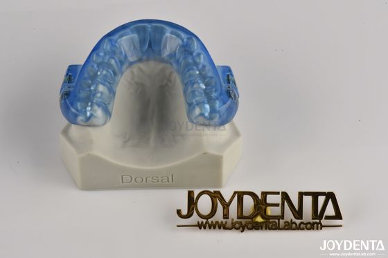 Mouthpiece regolabile anti russare / Protezione della bocca per russare