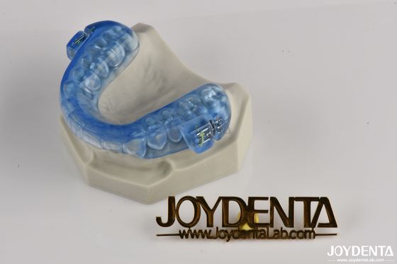 Dispositivo per russare dentale trasparente Protezioni per la bocca Risparmio da russare Protezione dei denti Comodo