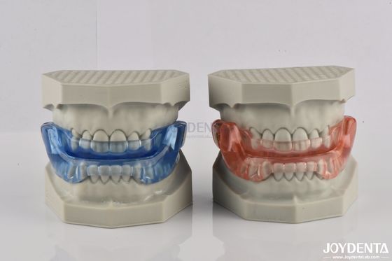 Apparecchi dentistici per fermare il russare