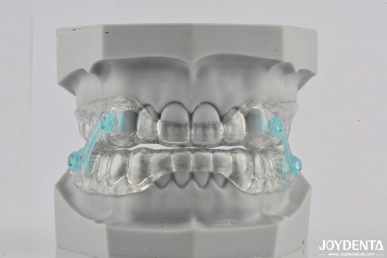 Mouthpiece anti russare in silicone Smetti di russare Apparecchio dentale Comodo
