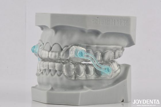 Adulti Dispositivo per russare trasparente in silicone Strumento per sgonfiare il russare colore trasparente