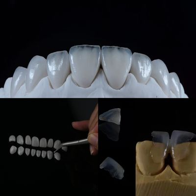 La finitura in vetro ceramica dà un sorriso naturale