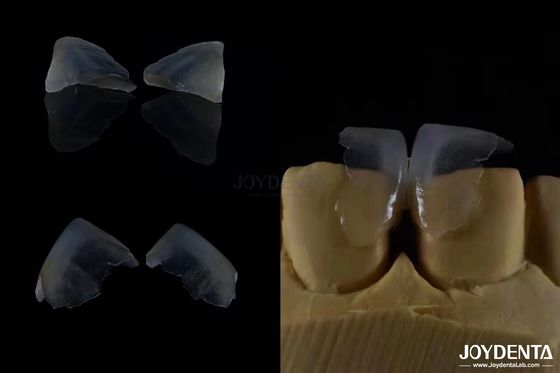 Mini-invasivo Veneer dentistici cosmetici vetro ceramica colore ultra sottile