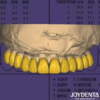 Software di progettazione dentale Digital Wax Up con sicurezza dei dati conforme HIPAA
