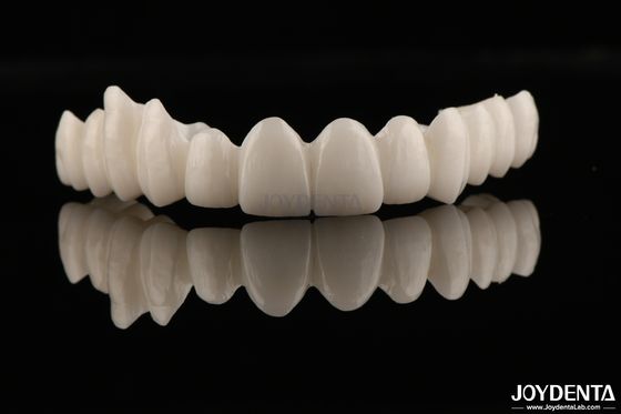 Alta estetica Full Zirconia Alta resistenza alla corrosione e all'usura per applicazioni esigenti