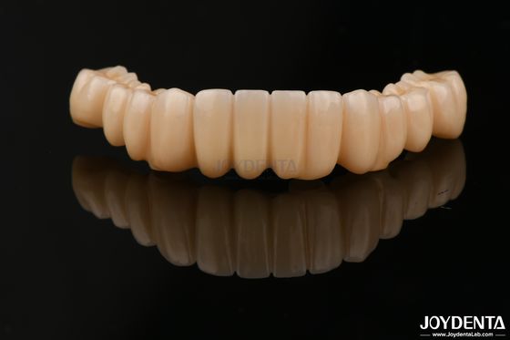 Alta precisione di contorno completo Zirconia Alta resistenza alle macchie per applicazioni dentali