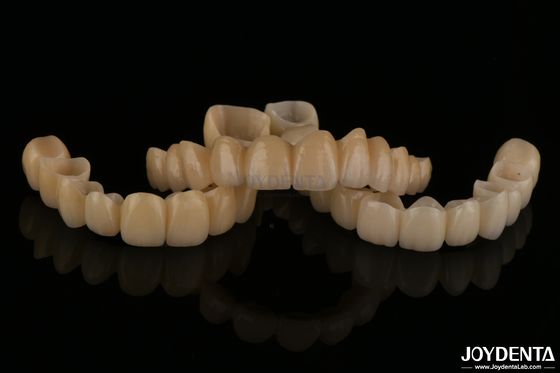 Ponte di zirconia in porcellana a strati di aspetto naturale resistenza all'usura alta biocompatibilità