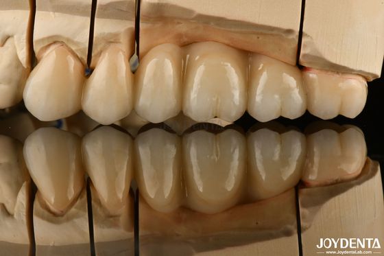 Di aspetto naturale Multilayer Full Zirconia Per Restaurazioni dentali Ultra Traslucide