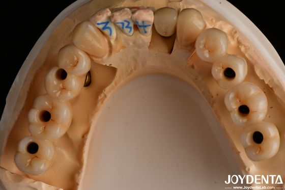 Alta traslucidezza multilivello di contorno completo zirconia naturale 1200 HV